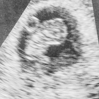 Babylist Registry Photo.