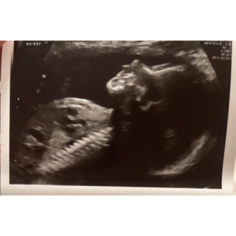 Babylist Registry Photo.