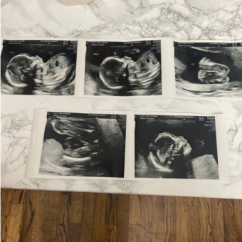 Babylist Registry Photo.