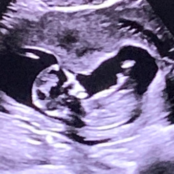 Babylist Registry Photo.