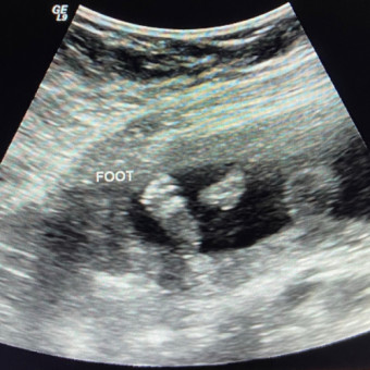 Babylist Registry Photo.