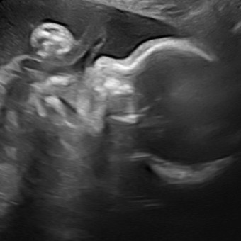 Babylist Registry Photo.