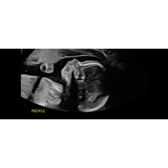 Babylist Registry Photo.
