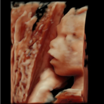Babylist Registry Photo.