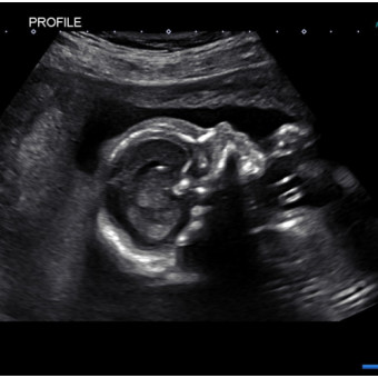 Babylist Registry Photo.
