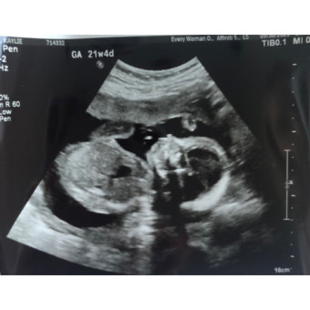 Babylist Registry Photo.
