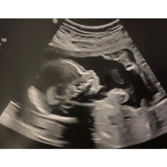 Babylist Registry Photo.