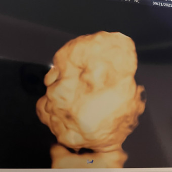 Babylist Registry Photo.