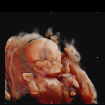 Babylist Registry Photo.