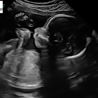 Babylist Registry Photo.