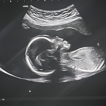 Babylist Registry Photo.