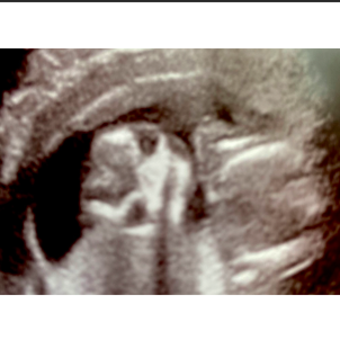 Babylist Registry Photo.