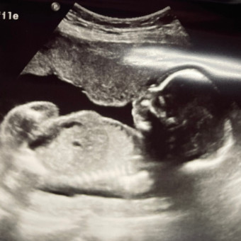 Babylist Registry Photo.