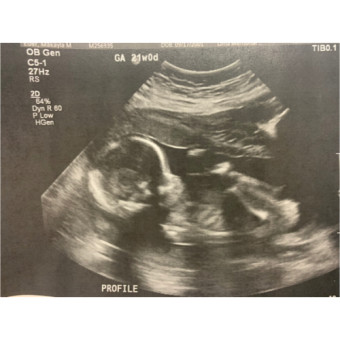 Babylist Registry Photo.