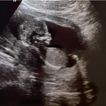 Babylist Registry Photo.