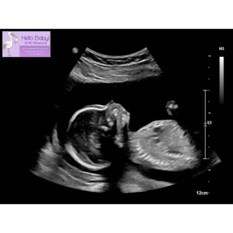 Babylist Registry Photo.