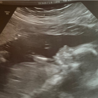 Babylist Registry Photo.
