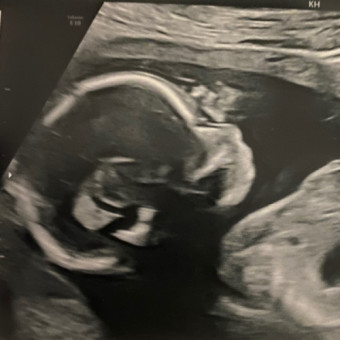 Babylist Registry Photo.
