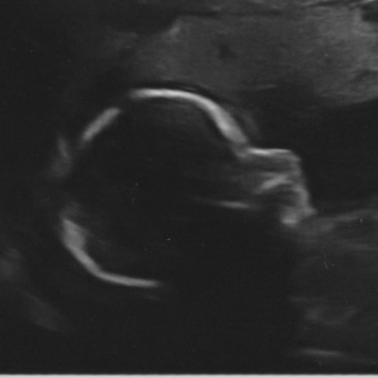 Babylist Registry Photo.