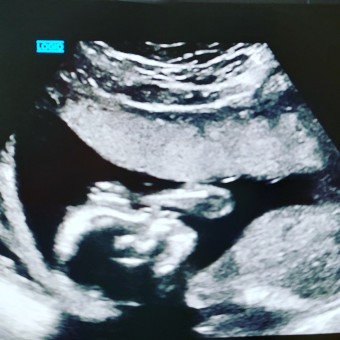 Babylist Registry Photo.
