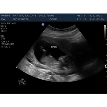 Babylist Registry Photo.