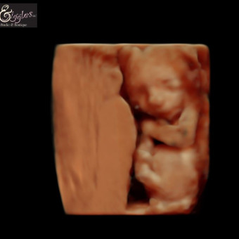 Babylist Registry Photo.