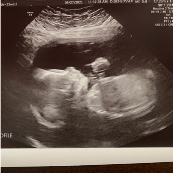 Babylist Registry Photo.