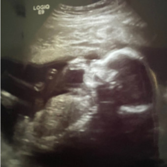 Babylist Registry Photo.