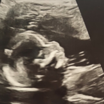 Babylist Registry Photo.