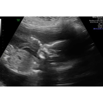 Babylist Registry Photo.
