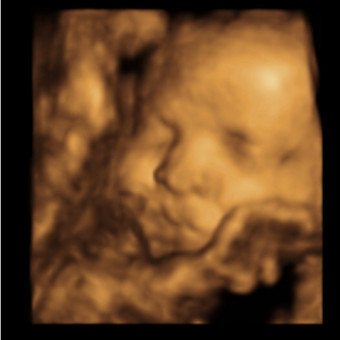 Babylist Registry Photo.