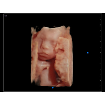 Babylist Registry Photo.