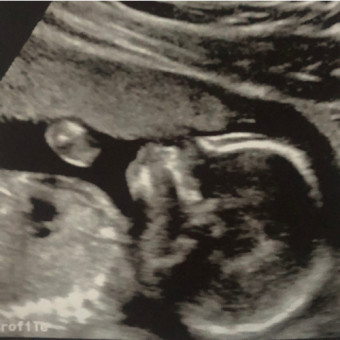 Babylist Registry Photo.