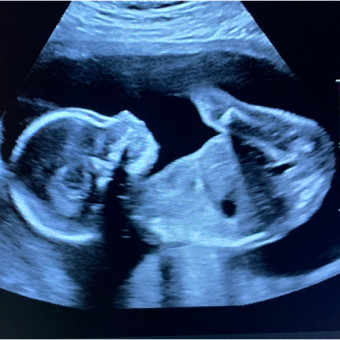 Babylist Registry Photo.