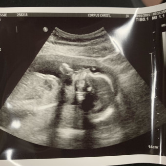 Babylist Registry Photo.