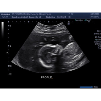 Babylist Registry Photo.