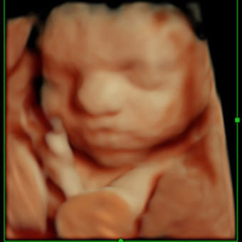 Babylist Registry Photo.