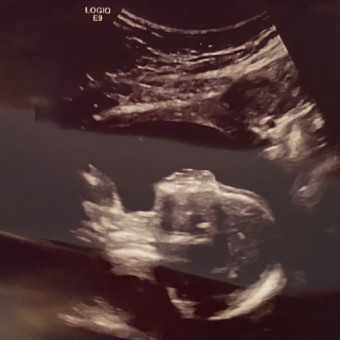 Babylist Registry Photo.