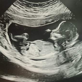 Babylist Registry Photo.