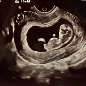 Babylist Registry Photo.