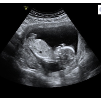 Babylist Registry Photo.