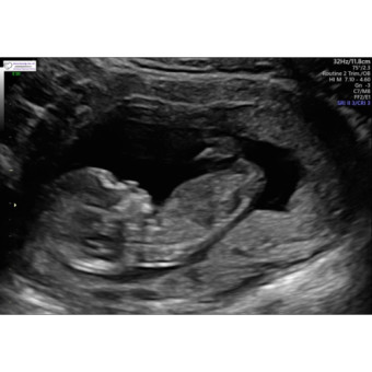 Babylist Registry Photo.