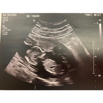 Babylist Registry Photo.