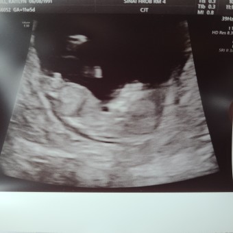 Brill Baby Registry Photo.