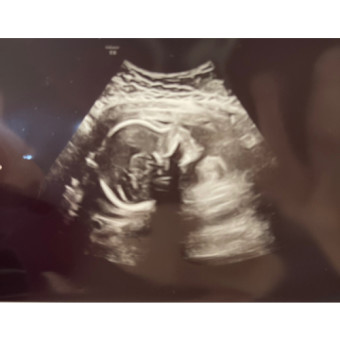 Babylist Registry Photo.