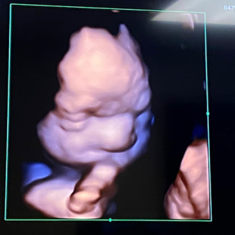 Babylist Registry Photo.