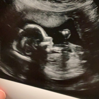 Babylist Registry Photo.