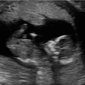 Babylist Registry Photo.