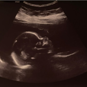 Babylist Registry Photo.