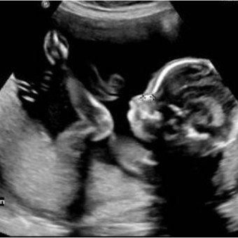 Babylist Registry Photo.